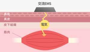 EMS技術