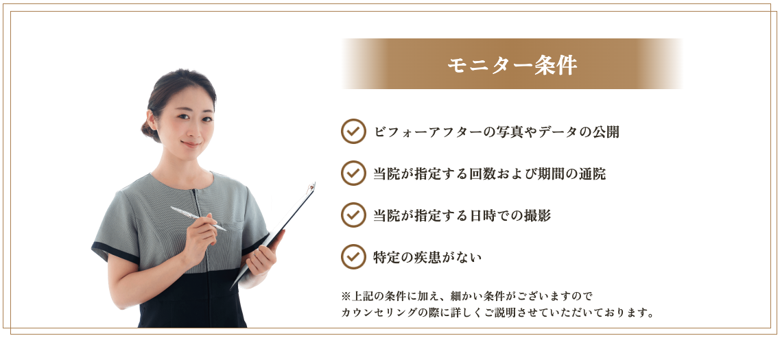 モニターになるための条件